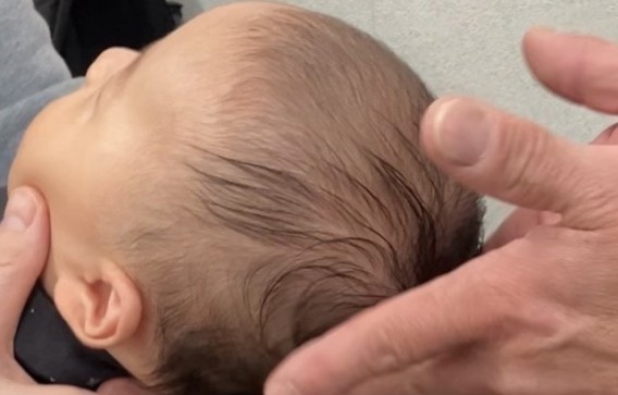 赤ちゃんの頭の形ケアで通院中のお子さん